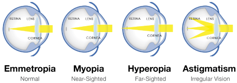 How the Eye Works Ophthalmologist San Francisco LaserVue