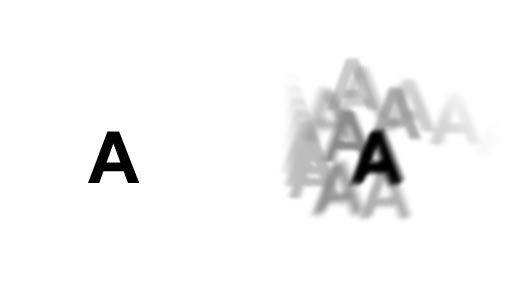 Keratoconus induced astigmatism and myopia example.