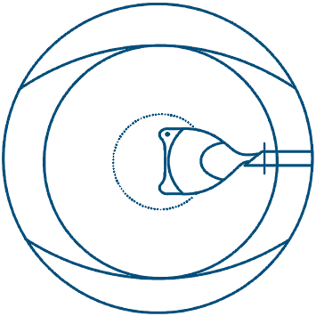 insertion positioning icon.png
