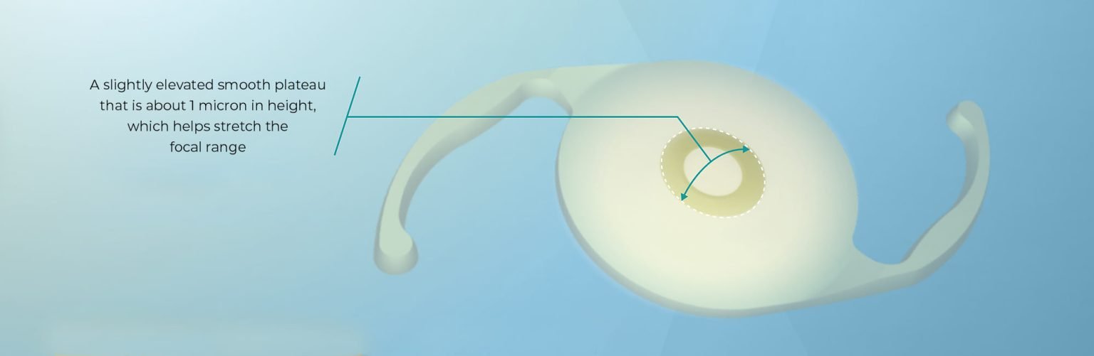 Alcon Vivity extended vision intraocular lens