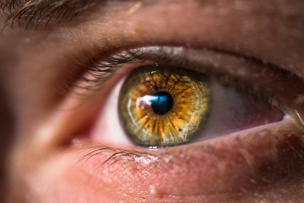 Close-up of a human eye with an amber iris