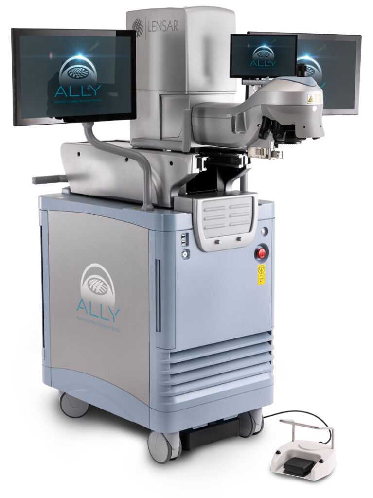 LensAR ALLY Laser for Robotic Laser Cataract Surgery Systems at LaserVue Eye Center